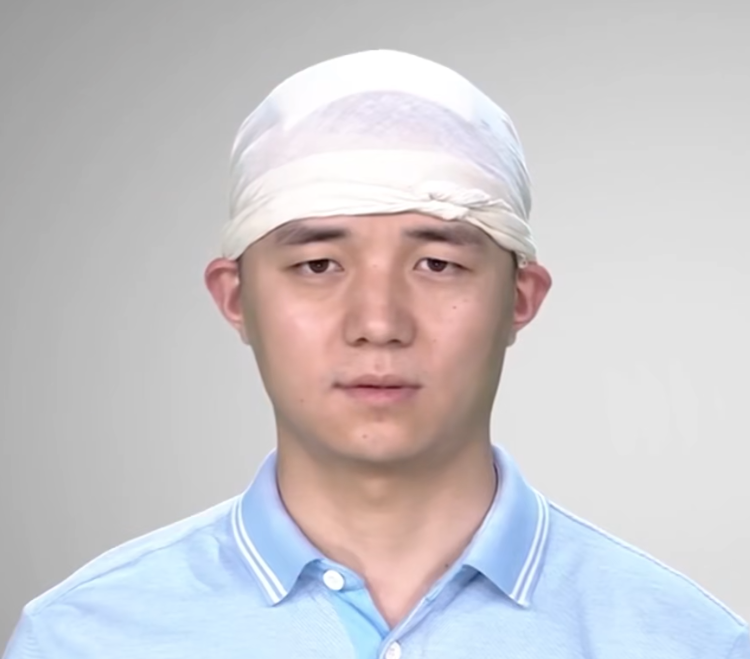 头顶帽式